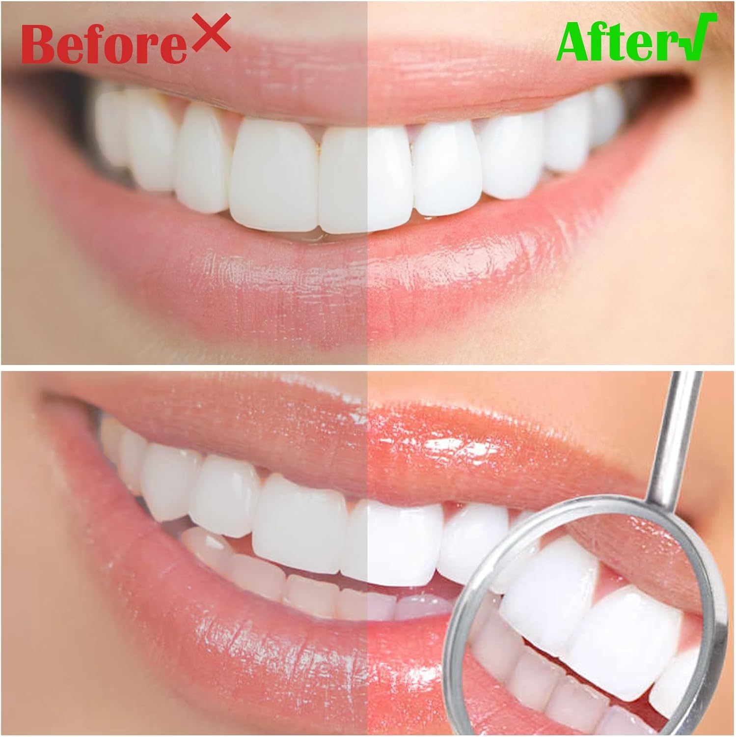 L-shaped Interdental Orthodontic Brush (6 pcs) - Image 8